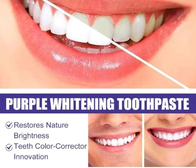 BRIGHTEN YOUR SMILE - Purple Whitening Toothpaste