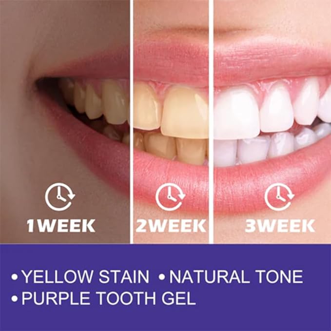 BRIGHTEN YOUR SMILE - Purple Whitening Toothpaste