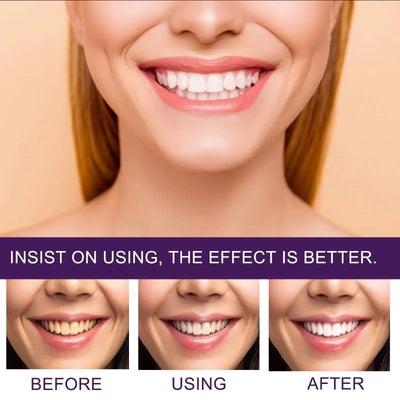 BRIGHTEN YOUR SMILE - Purple Whitening Toothpaste